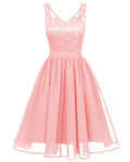 Women Sleeveless Styles Lace Shoulder Round Hem Dress