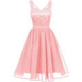 Women Sleeveless Styles Lace Shoulder Round Hem Dress